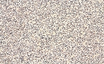 Silicon nitrides (Si3N4) are a range of advanced engineering ceramics characterised by high strength, toughness and hardness and excellent chemical and thermal stability. 