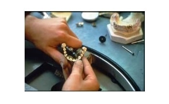 There are examples of the use of gold in dental applications as far
back as The Etruscans in the seventh century BC who used gold wire to
hold in place substitute teeth, usually from a cow or calf, when their
own were damaged.