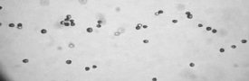 North Carolina State University research shows microscopic "two-faced" particles moving perpendicular to the direction of an electrical field, not in the direction of the field, as would be expected. 
