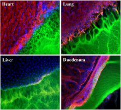 Images showing the interface between a surgical glue (green) and tissue samples (red, blue and black) from the heart, lung, liver, and duodenum. The glue works best with duodenum tissue (note smooth interface), and worst with lung tissue (pockmarked with holes). 