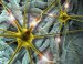 Brain implants that can more clearly record signals from surrounding neurons in rats have been created at the University of Michigan. The findings could eventually lead to more effective treatment of neurological disorders such as Parkinson's disease and paralysis. 