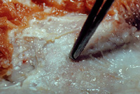 AZoM - Metals, ceramics, polymers and composites - ceramic composite materials used in spinal surgery.