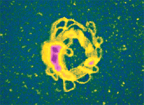 Condensed deoxyribonucleic acid (DNA) has been proposed as a gene delivery mechanism for biotechnology applications. Here, unfixed molecules were imaged in salt solution. 20μm scan.