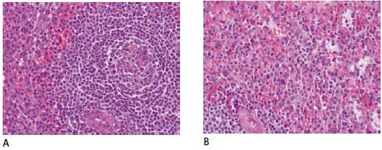 Photomicrographs of tonsil tissue stained with H&E. Rinsing steps and Scott