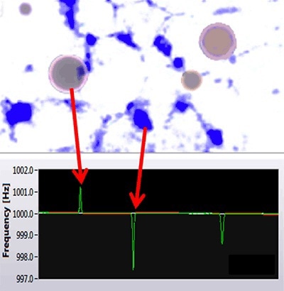 Archimedes can distinguish between silicone oil and protein aggregates.