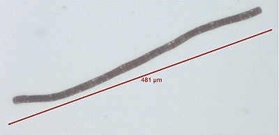 Morphologi G3 field of view color image of Trichodesmium bacterium.