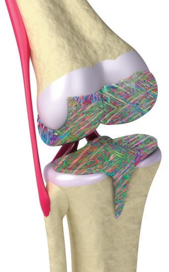 EBSD is an alternative characterization technique that provides comprehensive characterization of AM materials.