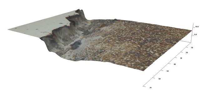 A sample of Ni alloy produced using a hot isostatic press (HIP) imaged using a Zeta-20 Optical Profiler. The Ni alloy has been electrolytically etched using a deep eutectic solvent. The image shows the step edge between the native (unetched) surface and the dissolved (etched) surface.