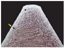 Fastener threads exhibiting decarburization (100X).