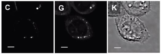 Adapted with permission from [2]. Copyright 2011 American Chemical Society. The figure shows SRS and transmission images of CHO cells incubated for 7 hours in the cell culture medium supplemented with 100µM deuterated palmitic acid (exogenous FA with C-D vibration). Figure 4C shows an SRS image of the C-D vibration and indicates the presence of exogenous FA in LD and cell membranes. Figure 4G shows an SRS image at the C-H vibration of the same cells and shows the distribution of endogenous FA in cells. Notably, the location of LD in 4C and 4G indicates that even when cells are supplemented with exogenous FA, intra-cellular LD contain both endogenous and exogenous FA. This suggests that the cell still synthesizes endogenous FA to facilitate the LD formation. The transmission image in Figure 4K lacks any chemical information found in the SRS images. Scale bar: 5 µm.