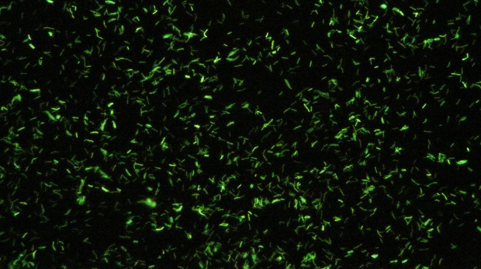 A fluorescent sample viewed under the microscope.