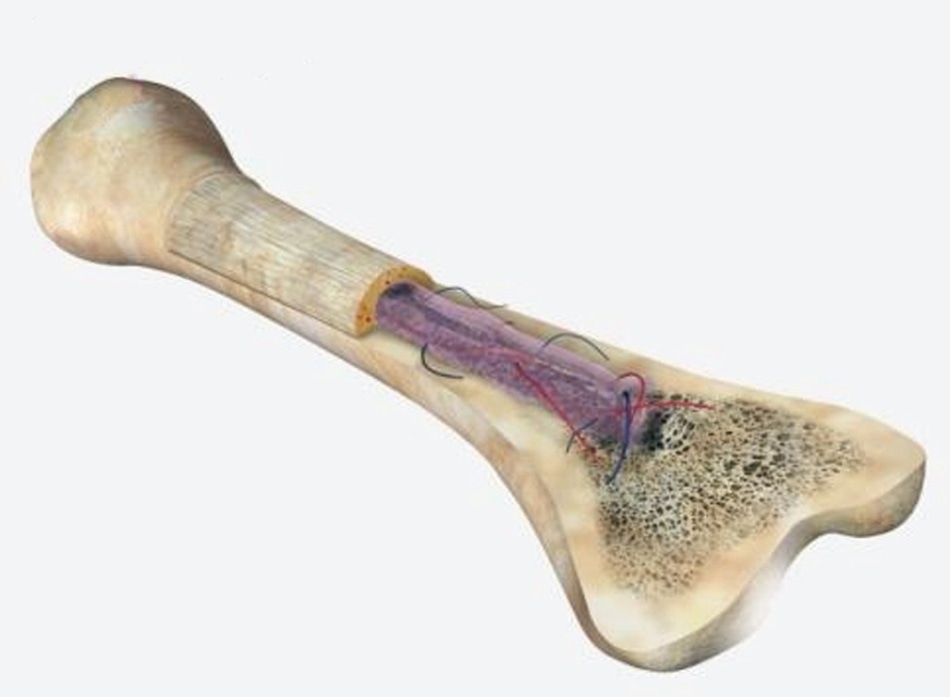 Advanced Mechanical Surface Testing of Bone Using ...