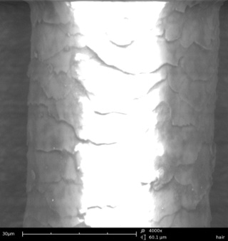SEM images of a human hair imaged in high vacuum (top) where charging is visible and in low vacuum (bottom), using the charged reduction sample holder.