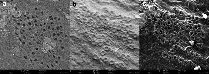a) Full BSD, b) Topography BSD and c) SED image of a leaf.
