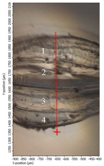 FTIR micrograph of Blood Bag