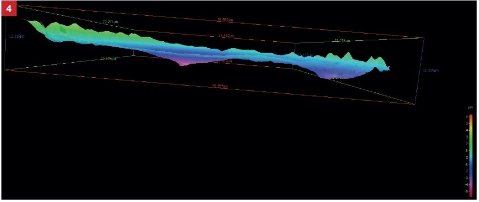 energy dispersive X-ray microanalysis (EDS).