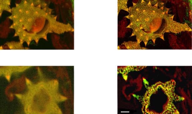 (above). Shows detail at full resolution from image in A above. Surface clarity is enhanced as well as sharpness and resolution improvement in individual pollen grain. Fig 14 c (below) shows single optical section from two channel daisy pollen Z series. ClearView-GPU enhances contrast, sharpens optical sectioning and provides clear channel separation in this thick bright specimen. Fine structures within the walls of the pollen grains become clearly visible. These punctate features are in the range 150-200 nm FWHM after deconvolution. Scale bar is 2 µm.