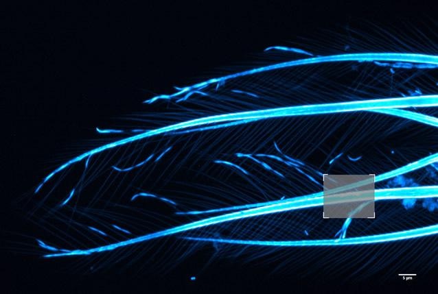 Brine shrimp tail captured with a 40 µm pinhole on Dragonfly