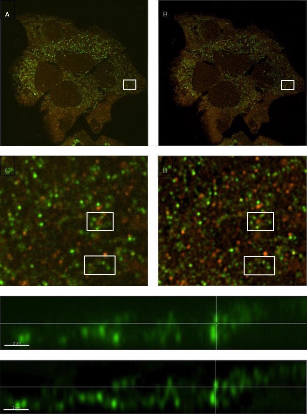 Comparison of a sample with labeled vesicles imaged using Dragonfly confocal mode (A, C & E) and following ClearView-GPUTM deconvolution (B, D & F). C and D show zoomed regions of A and B respectively, and within those regions, clusters of vesicles are much clearer to see in the deconvolved image (D) compared to the raw confocal image (C). E and F are orthogonal (x,z) views demonstrating smaller diameter profiles with higher contrast in the deconvolved image (F) owing to the reassignment of light omitted from each vesicle back to its origin.