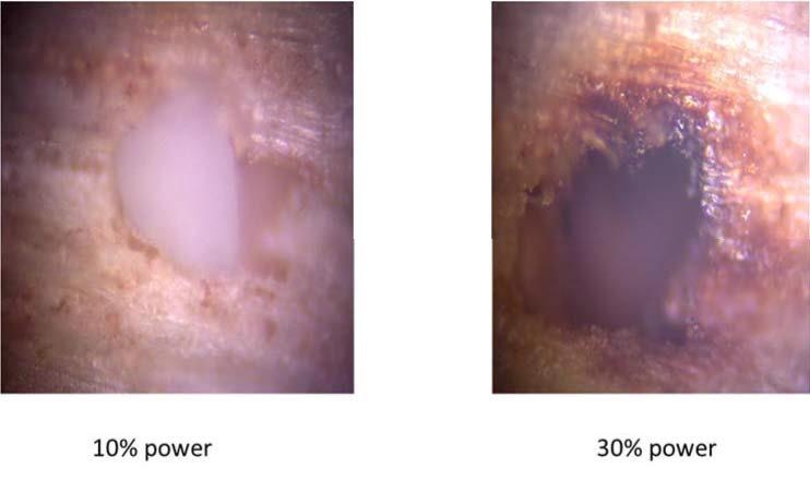 Post-blast dynamite particle after being irradiated with a laser power of 10% (left) and 30% (right).