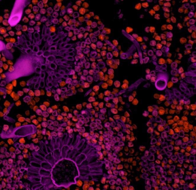 Features of sCMOS Cameras for Fluorescence Microscopy