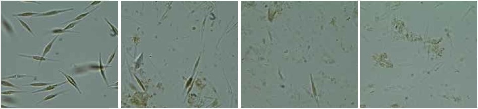 Cells of Phaeodactylum tricornutum before (left) and after cell disruption (middle and right) with the Mixer Mill MM 400 in combination with the adapter for conical centrifuge tubes; 3 x 60 seconds at 30 Hz.