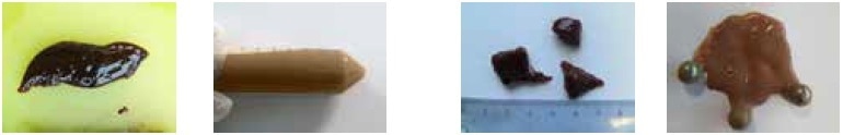 Liver sample before and after homogenization in the MM 400.