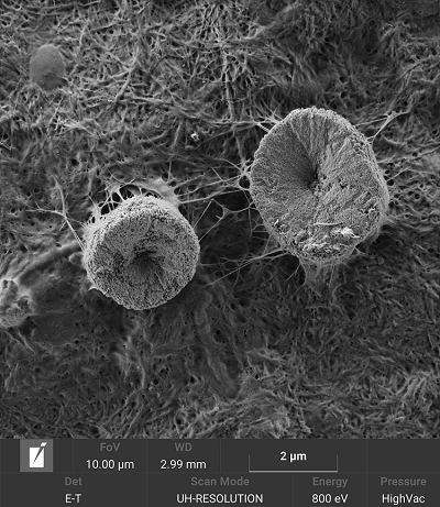 Bacterial cellulose is pure, biocompatible and highly versatile material. It can be combined with various biopolymers and micro and nanoparticles in order to be used in a wide range of applications including food industry, medicine, commercial and industrial products and other fields. To be able to visualize the ultrafine network of nanocellulose fibrils, low beam voltages and beam currents need to be used to obtain high resolution images of such a nonconductive and charging specimen.
