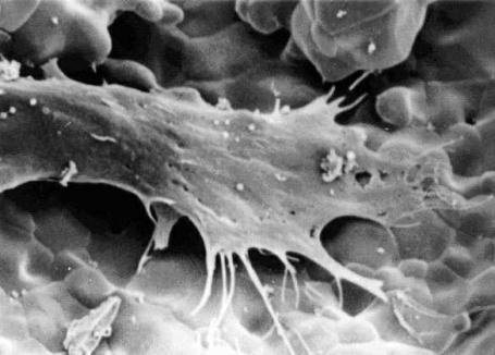 AZoM - Metals, ceramics, polymers and composites : Ceramic Foams – human response to a hydroxyapatite ceramic foam