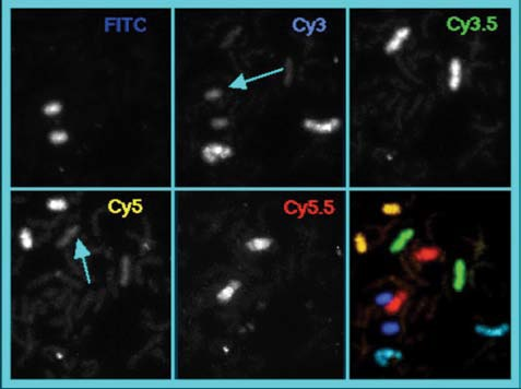 Fluorescence In Situ Hybridization (FISH) Imaging