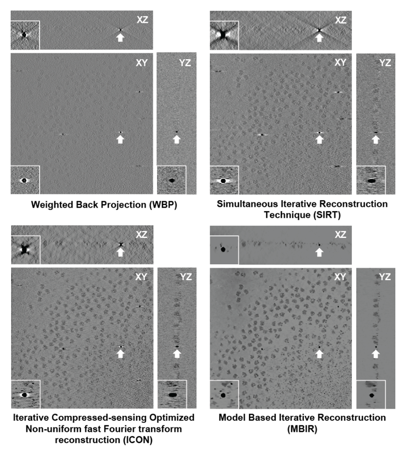 Comparison of tomographic reconstruction methods applied to a cryo-ET dataset.
