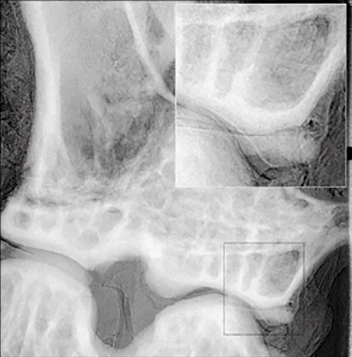 High-contrast image of cartilage in a mouse knee
