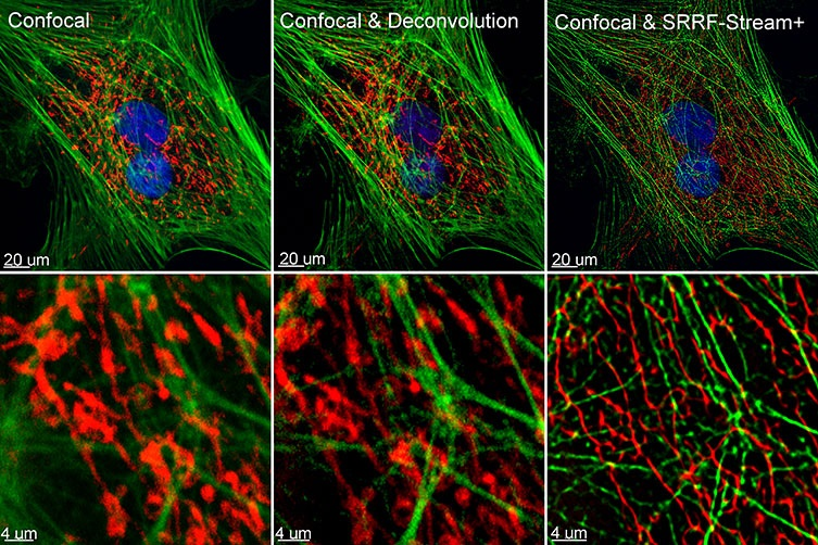 Comparison between confocal imaging, confocal imaging & deconvolution and confocal imaging & SRRF-stream+. High magnification close ups are present for a better visualisation of the obtained resolution. BPA cells stained with phalloidin, mitotracker and DAP image with Ixon 888 in confocal mode (no SRRF) and confocal mode with SRRF-stream+.