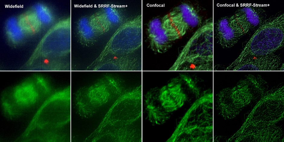 Comparison between different imaging modes (widefield and Confocal) with and without SRRF-Stream+ Hela cells stained for MLKP1(red), a-tubulin(green-microtubules) a and DAPI (blue-DNA) were image in the Dragonfly with an Ixon888 camera.