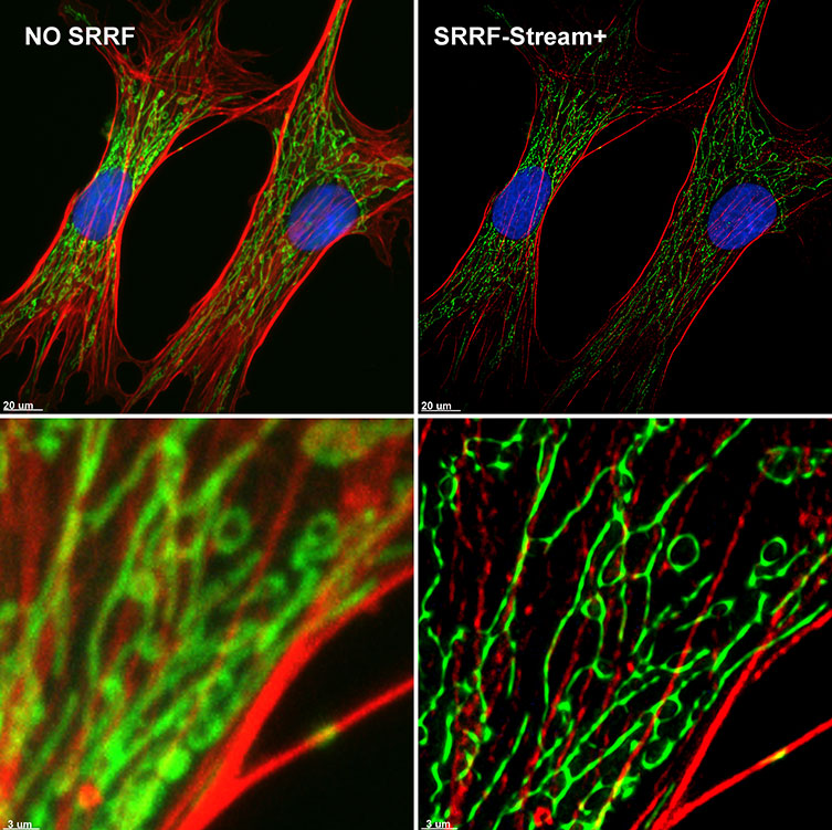 SRRF-Stream+ delivers High-quality Super-resolved images. BPA cells stained with phalloidin (red), mitotracker (green) and DAPI (blue) where imaged with Ixon 888 Ultra in confocal mode (no SRRF) and confocal mode with SRRF-stream+