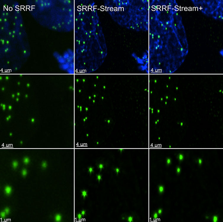 SRRF stream+ delivers high-quality data. At very high magnifications, in specific structures, such has kinetochores some Star artefact could occasionally appear. SRRF-Stream+ radiality computation in 24 directions eliminates the star artefacts. Hela cells stained for Cenp-A (green-Kinetochore) and DAPI (blue-DNA) were imaged in the Dragonfly with an Ixon888 Ultra camera.
