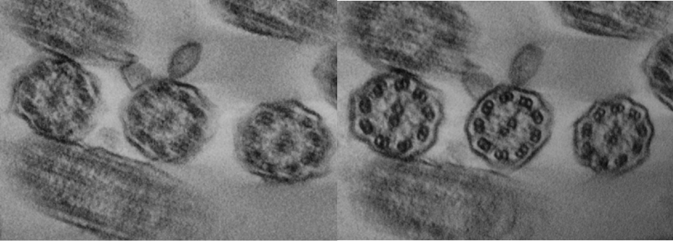 As in figure 2, but now from a PCD-case.