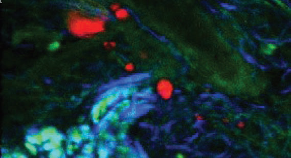 TPF (green), CARS from subcutaneous lipid deposits (red) and SHG from collagen (blue) of tissue from a mouse tail.