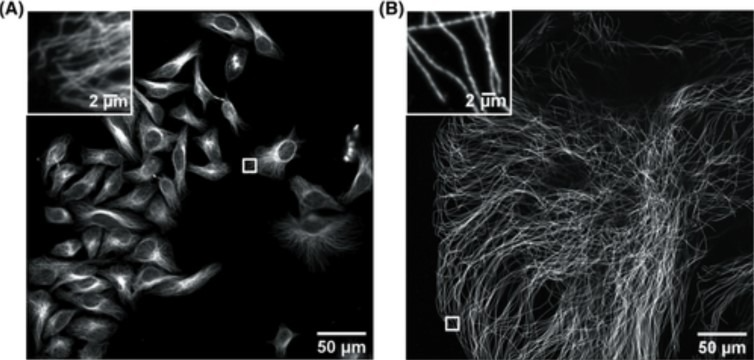 Confocal image of HeLa cells non expanded microtubules (right) and 4.5x linearly expanded microtubules (left).