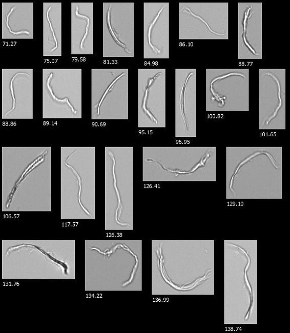 Example FlowCam images from a cellulose microfibril sample as seen in VisualSpreadsheet.