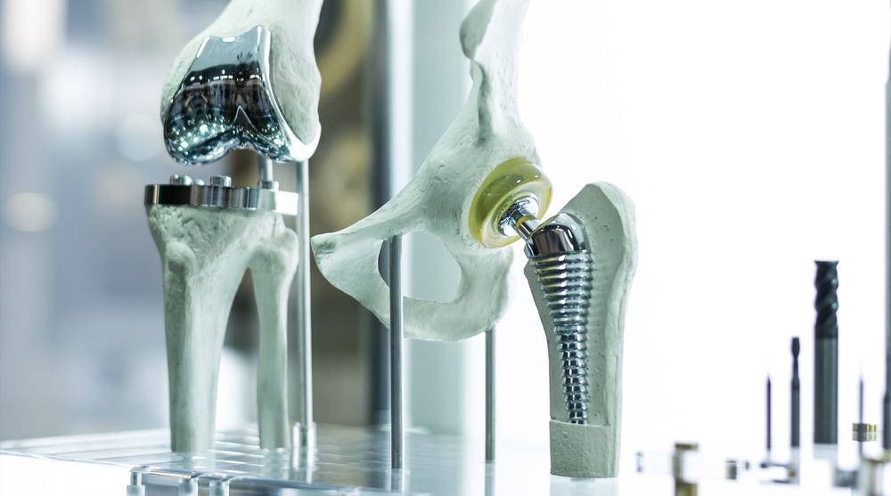 implants, 3d printing