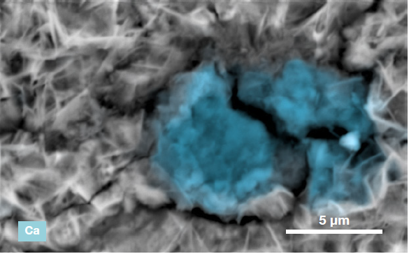 ChemiSEM images of the foreign particle. From top to bottom: backscattered electron image, calcium, fluorine, and silicon distribution. (Acc voltage 15 keV, beam current 0.85 nA, acquisition time 60 s).