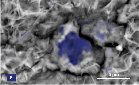 ChemiSEM images of the foreign particle. From top to bottom: backscattered electron image, calcium, fluorine, and silicon distribution. (Acc voltage 15 keV, beam current 0.85 nA, acquisition time 60 s).