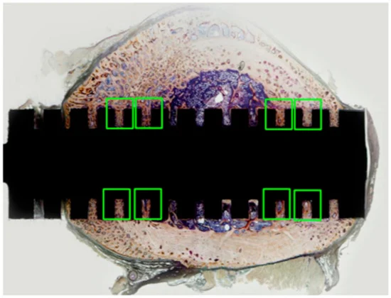 Cross-section of polished non-demineralized femur specimen (whole specimen). Pathological examination and bone histomorphometric assessment were focused on in the green-boxed areas, where the cortical bone contacted the slit portion of the implant because the bone formation was expected to be more active in those areas.