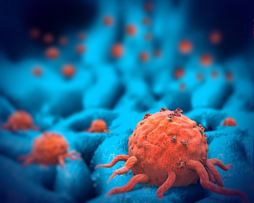 raman, raman spectroscopy, tumors, spectroscopy, cancer, immunotherapy, collagen, proline