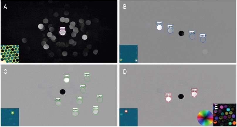 Virtual apertures and orientation mapping. A) Maximum diffraction pattern, where each pixel is the maximum value of that pixel over all patterns in the dataset. Inset: Virtual BF Image from the virtual aperture indicated in A. B – D) Diffraction patterns summed from the square regions specified in the corresponding insets. B – D Insets: Virtual DF images from the virtual apertures indicated in B – D. E) Map of brightest spot orientation and intensity. The color hue in the map specifies the direction from center of the strongest spot in the diffraction pattern, while the brightness corresponds to the intensity of this peak. The average pattern over all pixels was subtracted from the data.