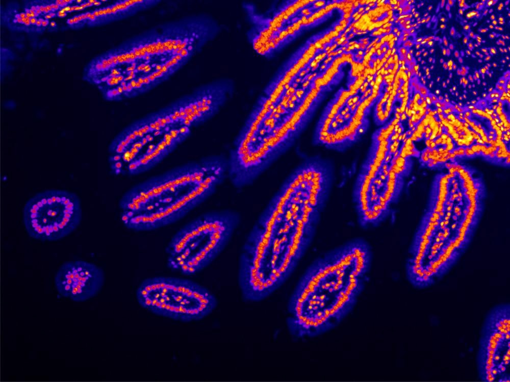 x-ray, fluorescence, x-ray fluorescence, synchrotron-based, synchrotron-based x-ray fluorescence, microscopy, fluorescence microscopy