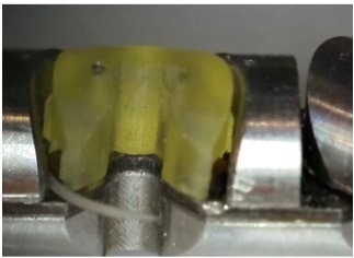 3D printed component to stabilize the needle path.