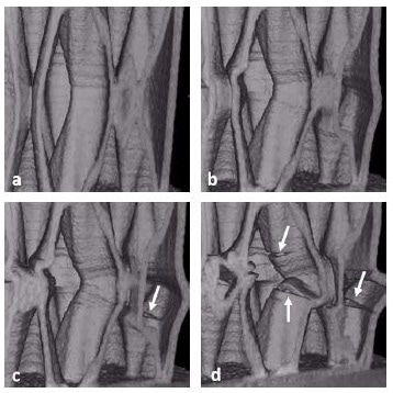 Detail of layer separation on the Cross 3D sample at different time points during compression. a) 3.5 minutes b) 5.8 minutes c) 6.5 minutes d) 8.3 minutes.