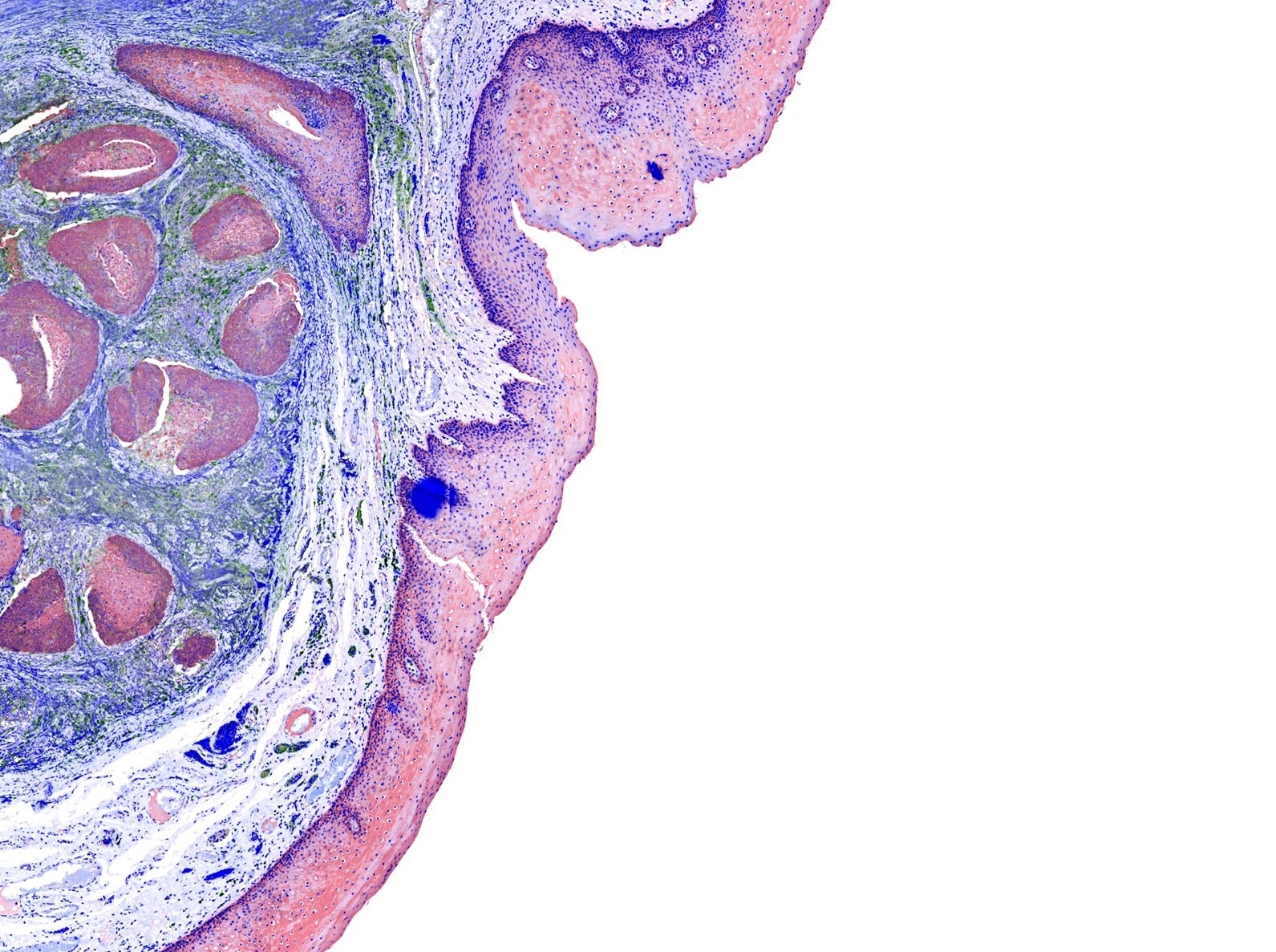 Advancing Medical Diagnostics: The Role of Spectroscopy in Precise Tissue Identification and Treatment